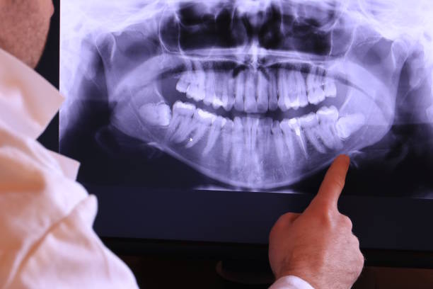 Best Emergency Treatment for Dental Infections or Abscesses in West Salem, OH