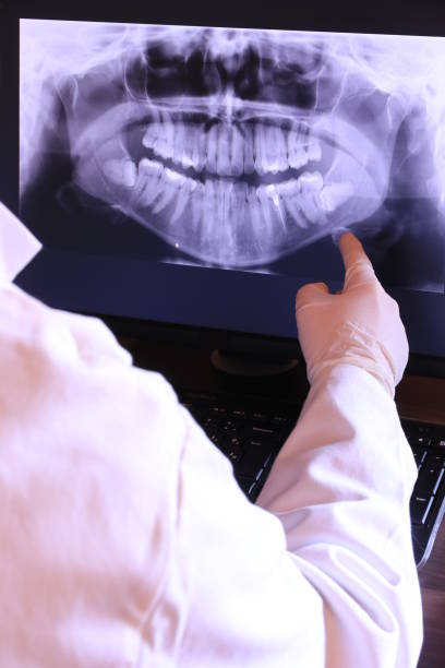 Best Emergency Tooth Extraction in West Salem, OH