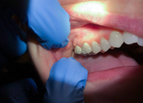 Best Emergency TMJ Treatment in West Salem, OH