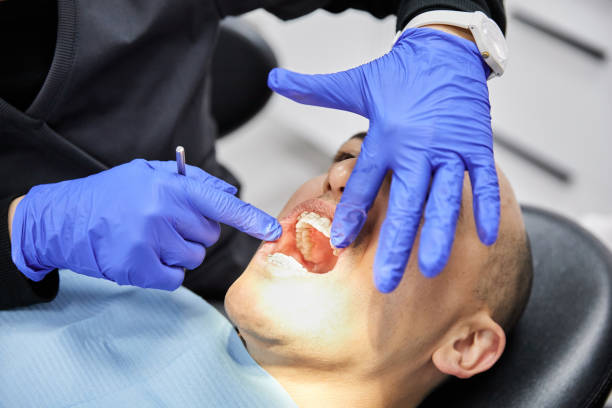 Best Emergency Gum Treatment in West Salem, OH